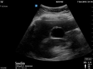 proper GB wall measurement